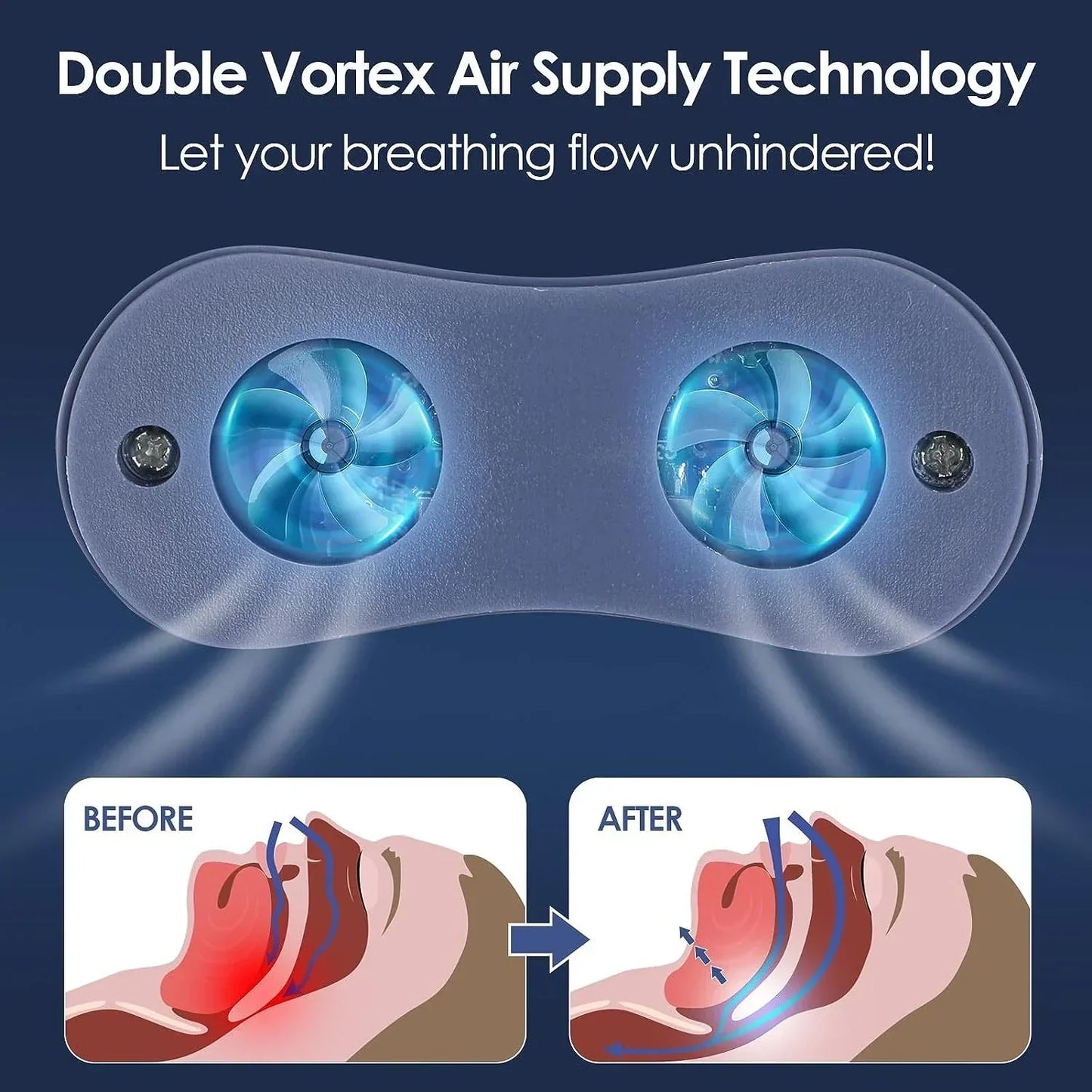 AeroSleep | Micro CPAP Travel Machine Hoseless Anti Snoring Device