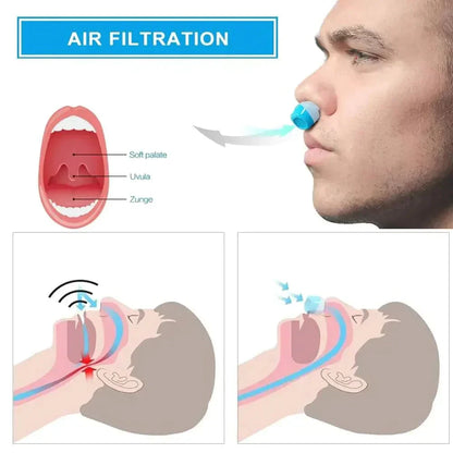 AeroSleep | Micro CPAP Travel Machine Hoseless Anti Snoring Device