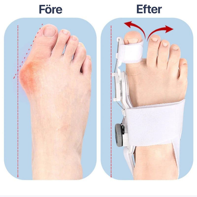 Adjustable Big Toe Straightener | Hallux Valgus Alignment Brace for Foot Comforta