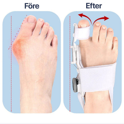 Adjustable Big Toe Straightener | Hallux Valgus Alignment Brace for Foot Comforta